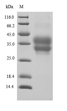 Recombinant Human Programmed cell death protein 1(PDCD1),partial (Active)