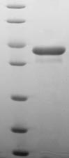 Recombinant Human Programmed cell death protein 5(PDCD5)
