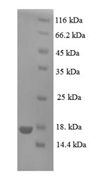 Recombinant Human Prolactin-inducible protein(PIP)