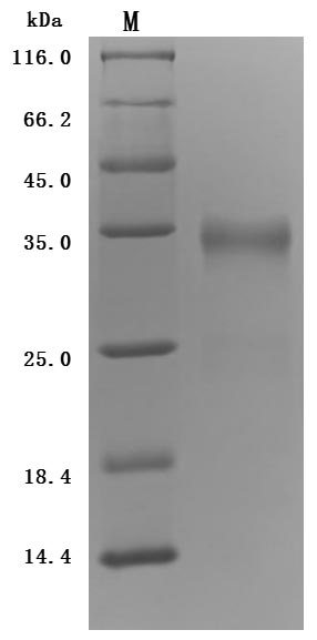 Recombinant Human Prolactin receptor(PRLR),partial (Active)