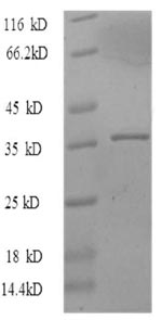 Recombinant Human Proliferation marker protein Ki-67(MKI67),partial