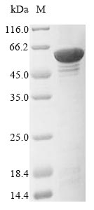 Recombinant Human Prolyl 4-hydroxylase subunit alpha-1(P4HA1)