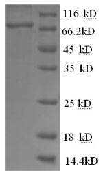 Recombinant Human Prostaglandin G/H synthase 2(PTGS2),partial