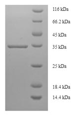 Recombinant Human Prostaglandin-H2 D-isomerase(PTGDS)