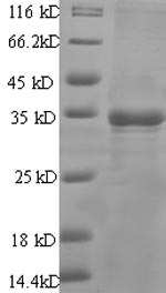 Recombinant Human Prostate stem cell antigen(PSCA)