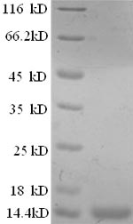 Recombinant Human Prostate stem cell antigen(PSCA),partial
