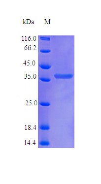 Recombinant Human Protein NOV homolog protein(NOV) (Active)