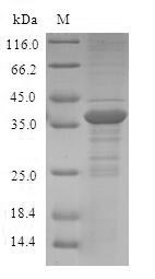 Recombinant Human Protein S100-A12(S100A12)