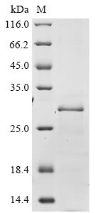 Recombinant Human Protein Wiz(WIZ),partial