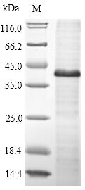 Recombinant Human Protein Wnt-5a(WNT5A)