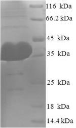 Recombinant Human Protein argonaute-2(AGO2),partial