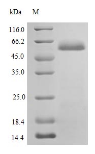 Recombinant Human Protein disulfide-isomerase protein(P4HB) (Active)