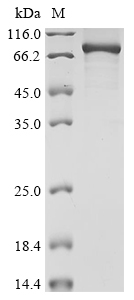 Recombinant Human Protein kinase C delta type(PRKCD)