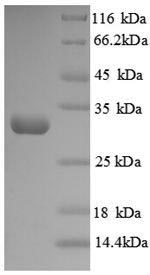 Recombinant Human Protein-lysine 6-oxidase(LOX),partial
