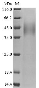 Recombinant Human Protein mono-ADP-ribosyltransferase PARP14(PARP14),partial