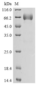 Recombinant Human Protein mono-ADP-ribosyltransferase PARP14(PARP14),partial