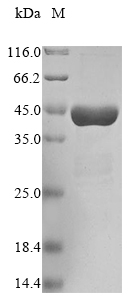 Recombinant Human Protein/nucleic acid deglycase DJ-1(PARK7),partial