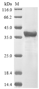 Recombinant Human Protein patched homolog 2(PTCH2),partial