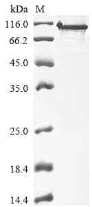 Recombinant Human Protein phosphatase 1 regulatory subunit 15A(PPP1R15A),partial