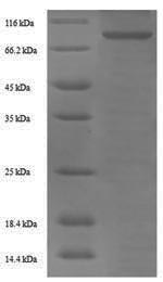 Recombinant Human Prothrombin(F2)
