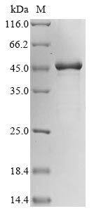 Recombinant Human Putative beta-actin-like protein 3(POTEKP)