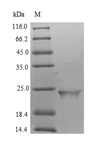 Recombinant Human Putative inactive neutral ceramidase B(ASAH2B)