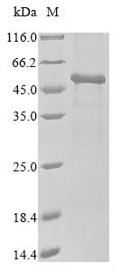 Recombinant Human Pyruvate dehydrogenase E1 component subunit alpha, somatic form, mitochondrial(PDHA1),partial