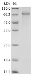 Recombinant Human Pyruvate dehydrogenase E1 component subunit alpha, somatic form, mitochondrial(PDHA1),partial