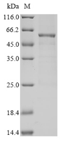 Recombinant Human Pyruvate dehydrogenase protein X component, mitochondrial(PDHX)