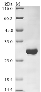 Recombinant Human Ras GTPase-activating protein SynGAP(SYNGAP1),partial