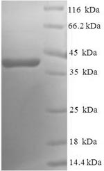 Recombinant Human Ras-related protein Rab-5A(RAB5A)
