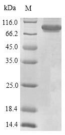 Recombinant Human Receptor-type tyrosine-protein phosphatase C(PTPRC),partial