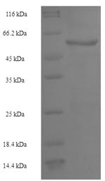 Recombinant Human Receptor-type tyrosine-protein phosphatase beta(PTPRB),partial