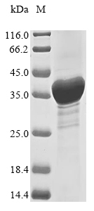 Recombinant Human Receptor tyrosine-protein kinase erbB-2(ERBB2),partial