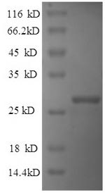 Recombinant Human Reelin(RELN),partial