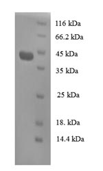 Recombinant Human Regenerating islet-derived protein 3-alpha(REG3A)