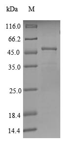 Recombinant Human Regulator of G-protein signaling 17(RGS17) (Active)