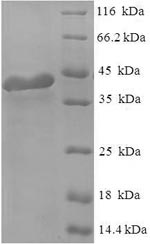 Recombinant Human Regulator of G-protein signaling 2(RGS2)