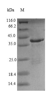 Recombinant Human Renin receptor(ATP6AP2)