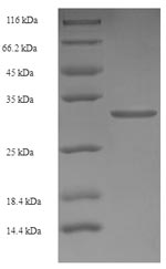 Recombinant Human Retinoic acid receptor responder protein 2(RARRES2)