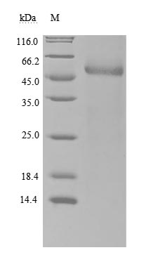 Recombinant Human Retinol-binding protein 4(RBP4) (Active)