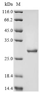 Recombinant Human Rho guanine nucleotide exchange factor 12(ARHGEF12),partial