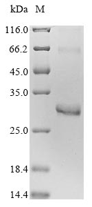 Recombinant Human Rho-related GTP-binding protein RhoD(RHOD)