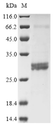 Recombinant Human Rho-related GTP-binding protein RhoG(RHOG)