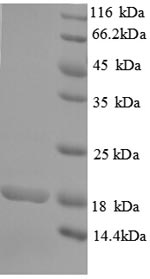 Recombinant Human Rhomboid-related protein 2(RHBDL2),partial