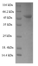 Recombinant Human Ribokinase(RBKS),partial