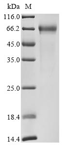 Recombinant Human Ribonuclease T2(RNASET2)
