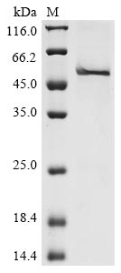 Recombinant Human Ribonuclease inhibitor(RNH1)