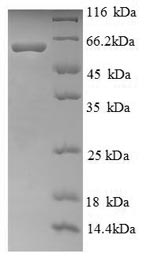Recombinant Human Ryanodine receptor 1(RYR1),partial