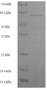 Recombinant Human S-phase kinase-associated protein 2(SKP2) 
